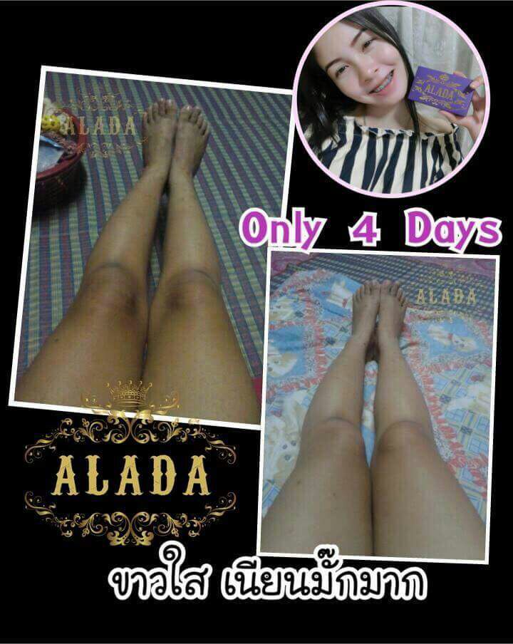 ALADA